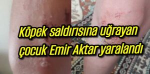 Köpek saldırısına uğrayan Emir aktar yaralandı