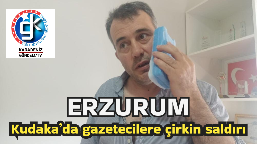 Kudaka’da gazetecilere çirkin saldırı